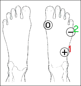 Afbeeldingeditor - Tekening met markeringen