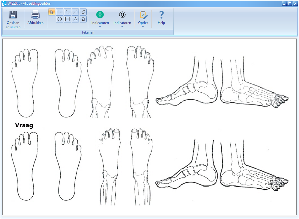 Afbeeldingeditor - Bewerken 1